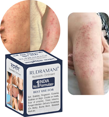 RAHIPA Rudramani Fungal Relief Malam | Ayurvedic Marham for Ringworm and Severe Itching(25 g)