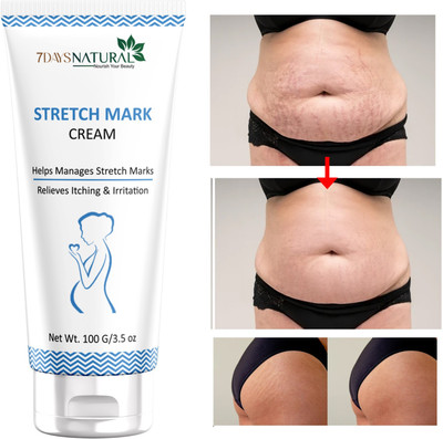 7days natural Stretch Marks Removal Cream for Remove dark spot circles, Acne Blemishes Intimate Cream(100 g, Pack of 1)