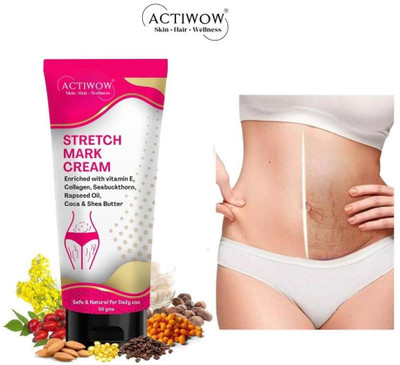 ACTIWOW Stretch Marks Removal Tube For, Ultra Nourishing(50 g)