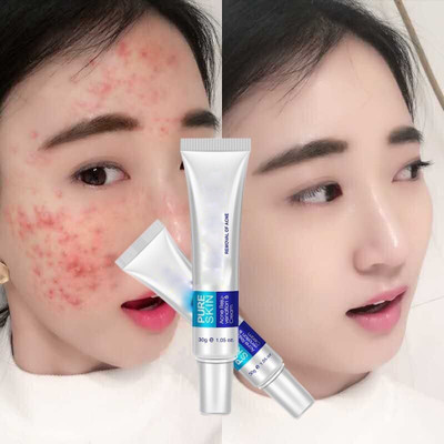 EVERERIN Pigmentation Blemishes Face Cream, For Pigmentation & Blemish Removal(60 g)