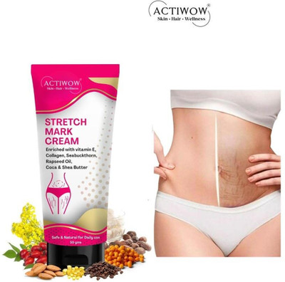 ACTIWOW Stretch Marks Removal Tube For, With Licorice & Lemon(50 g)