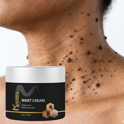 MAXERRA Herbal Wart Removal Cream for Smooth Clear Skin | Painless Removal Cream Wart Cream- 50g(50 g)