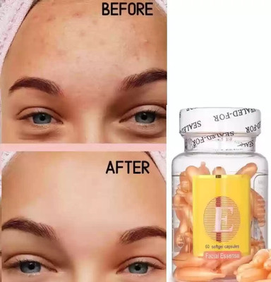 GFSU - GO FOR SOMETHING UNIQUE Professional Aloe Vera & Vitamin E Anti Wrinkle Spot Acne Removing Whitening Moisturizing Facial Capsules(24 g)