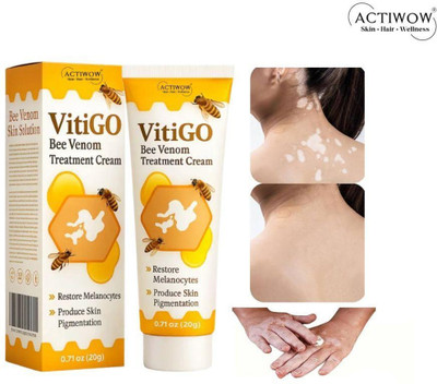 ACTIWOW Vitigo Bee Venom Cream for Glow Boosting Hydration Cream(100 g)