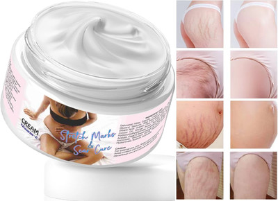 tanvi27 Prevents and Fades Pregnancy & Prevents and Fades Pregnancy Obesity Scars Obesity Scars(50 g)