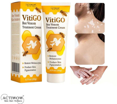 ACTIWOW Vitigo Bee Venom Cream for Smooth Nose Texture(100 g)
