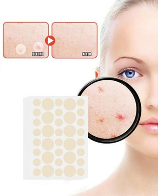 tanvi27 Pimple Patches 36 Count Acne for Covering Zits and Blemishes(5 g)