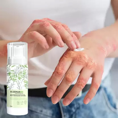 Dr. DAHAO Herbal Eczemaron Anti Fungal Cream For Men & Women(50 g)