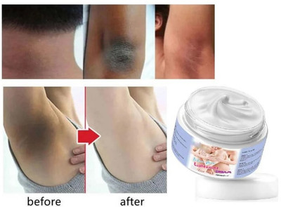 house of common Bikini Skin Whitening And Darkness Reduction Cream For All Skin Type(50 g)