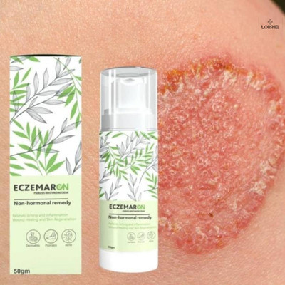 LORSHEL Eczemaron Fungal Cream - Herbal Cream, Painless Application, Premium Quality(50 ml)