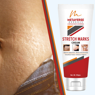 METAVERSE Stretch mark fading cream aids in reducing their visibility Under Arm Body Mark(100 g)