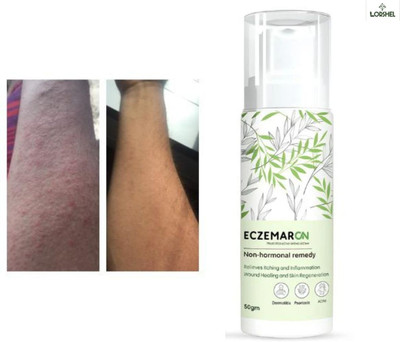 LORSHEL Eczemaron Fungal Cream - Gentle on Skin, Plant Based, Natural Formula(50 ml)