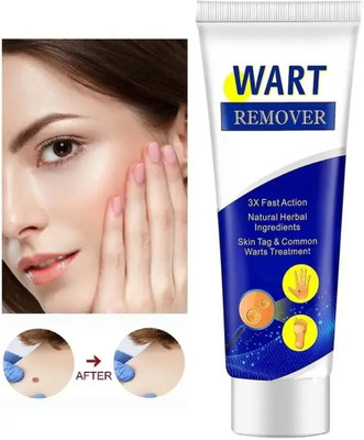 Acufit Wart Cream Herbal Wart Removal Cream Men & Women -/pack-1(100 g)