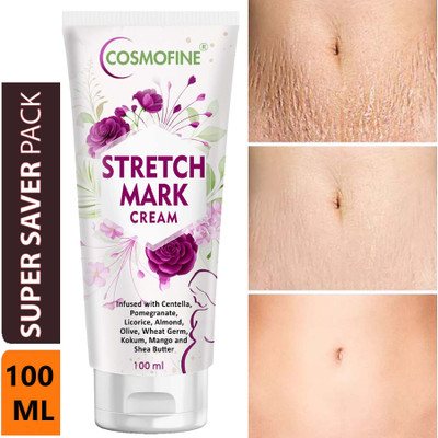 cosmofine Stretch Mark Cream, Scar Marks Removal Cream, Pregnency Stretch Mark Removal(100 ml)