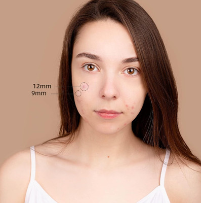 CATERINACHIARA Face Acne Pimple Patch - Pack of 36(36 g)