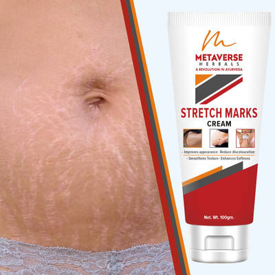 METAVERSE Embrace beautiful skin with our potent stretch marks cream(100 g)
