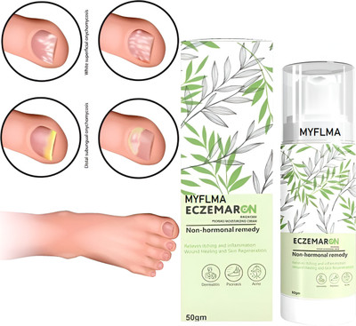 MYFLMA Herbal Eczema Spray Pack Of 1(50 g)