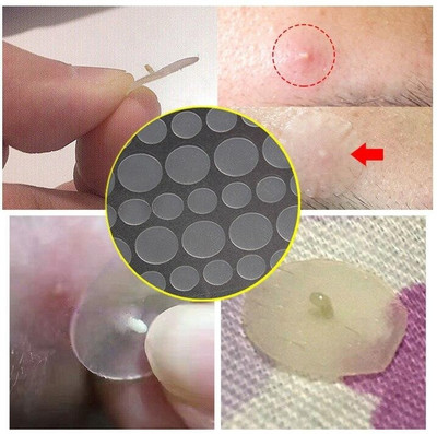GULGLOW99 Pimple Patches for Face Blemish Patches, Acne Dots, Pimple Stickers(36 g)
