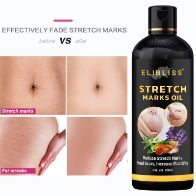 ELIBLISS Stretch Mark Removal Oil Women & Men, Marks & Spots Removal(100 ml)