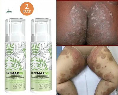 LORSHEL Eczemaron Fungal Cream : safe for daily use & natural herbal antifungal formula(100 ml)
