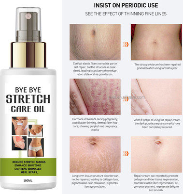 Jasoliya Bye Bye Stretch Oil – 100ml Advanced Scar & Mark Solution(100 ml)