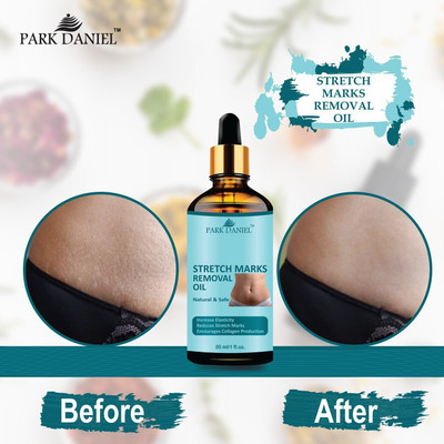 PARK DANIEL Premium Stretch Marks Removal Oil & Even Out Skin Tone Pack of 1 30 ML(30 ml)