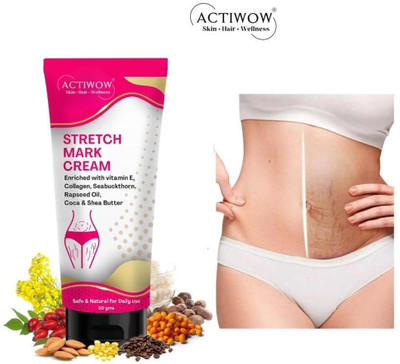 ACTIWOW Stretch Marks Removal Tube For, Eco‑Friendly Formula(50 g)