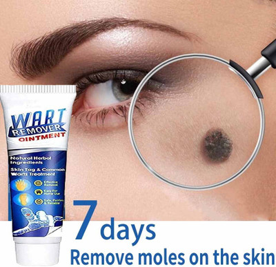 GULGLOW99 Wart Treatment Unique Cream Warts Remover Ointment Skin(100 g)