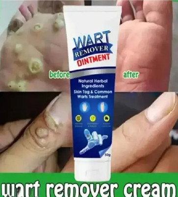 EVERERIN Skin Wart Removal Cream For All Skin Types(100 g)