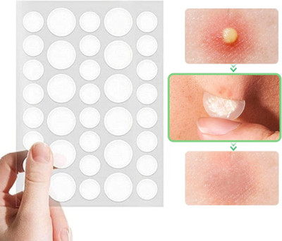 FLORERO Acne Pimple Patches- Day and Night 2 sizes(20 g)