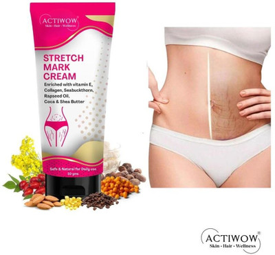 ACTIWOW Stretch Marks Removal Tube For, Soft Skin Restorer(50 g)