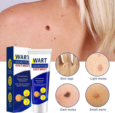 manasona Wart Remover Ointment for Acne Moles Scar(100 g)