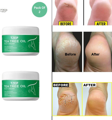 TZEP Tea Tree Oil Foot Cream : Paraben Free & Odor Control(100 g)