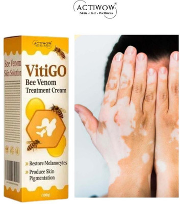 ACTIWOW Vitigo Bee Venom Cream for Skin Nourishment(100 g)