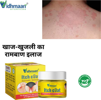 vidhmaan ayurveda ayurvedic itch coat malam Itch Relief Cream - Natural Treatment for Skin Rashes, Eczema & Allergies skin problem(25 g)