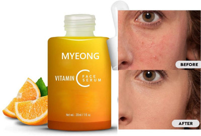 MYEONG Vitamin C Face Serum Hydrates & Glow Boost Smoothing Your Skin Serum(30 ml)