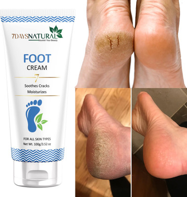 7days natural feet Smooth Foot Crack Cracked Heel Repair Foot Cream(100 g)