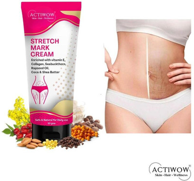 ACTIWOW Stretch Marks Removal Cream, Perfect Skin Partner(50 g)