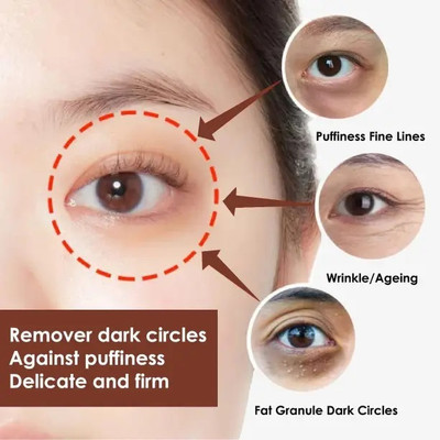 Bijlan Cosmetic Under Eye Cream for Dark Circle, Puffiness & Fine Lines, Moisturizes the Skin(50 g)