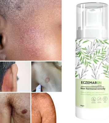 Eczemaron Ringworm Antifungal Spray(50 g)
