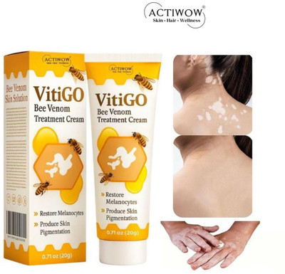 ACTIWOW Vitigo Bee Venom Cream for Smooth Lip Corners(100 g)