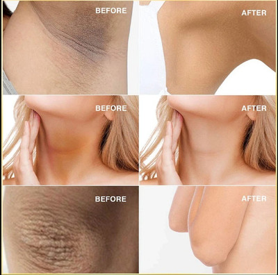 Bijlan Cosmetic Whitening Cream for Sensitive Areas & Bikini Line-04(50 g)