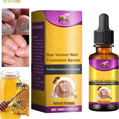 AYYIASHI Fungi Free Serum For Nail Repair Cure And Healthy Shine Nails(30 ml)