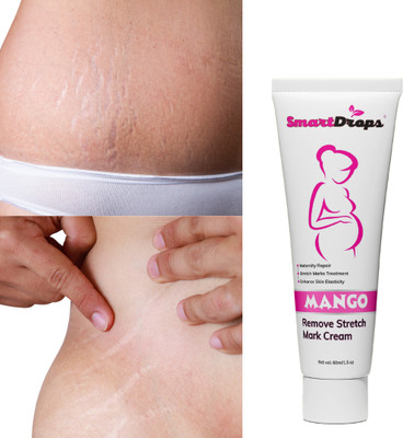 smartdrops Scar & Stretch Mark Removal Body Use Cream for Stretch and Spot Marks on Skin(60 ml)
