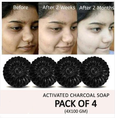Kalah Herbals ACTIVATED CHARCOAL Natural Hand Made Soap Pack of 4(4 x 100 g)