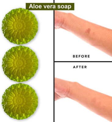 CHITAKSH Aloe Vera Soap with Green Tea Extract (100GM) (PACK OF 3)(300 g)
