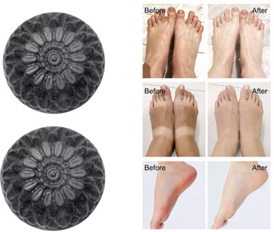 CHITAKSH Get clearer skin with our activated charcoal soap(2 x 100 g)