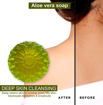CHITAKSH Organic Aloe Vera Soap for a Chemical-free and Eco-friendly Bathing Experience(100 g)