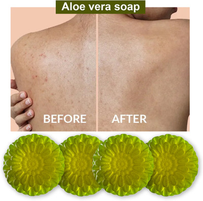 TERIHAR Aloe Vera Soap with Lavender and Chamomile for Relaxation (100GM) (PACK OF 4)(400 g)