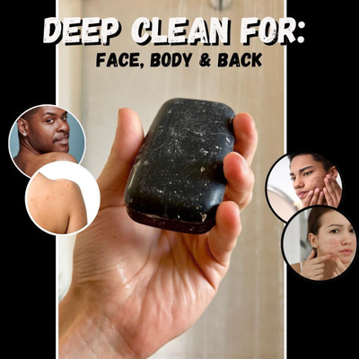 REIMICHI Charcoal Soap Reduces acne and blackheads(125 g)